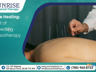 Understanding Patient Safety in Dry Needling Therapy