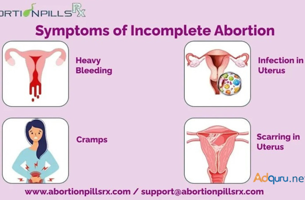 what-are-symptoms-of-incomplete-abortion-after-taking-mtp-kit-big-0