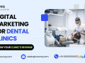 digital-marketing-strategies-for-dentists-nounq-technologies-small-0