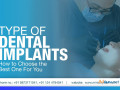 dental-implants-in-gurgaon-small-1