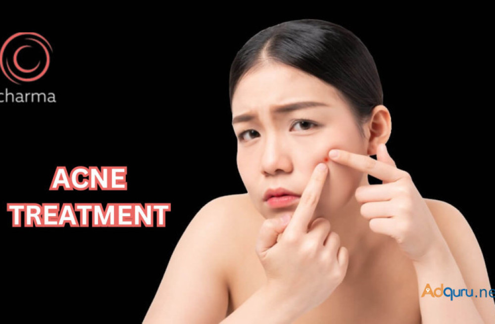 acne-treatment-in-bangalore-charma-clinic-big-0