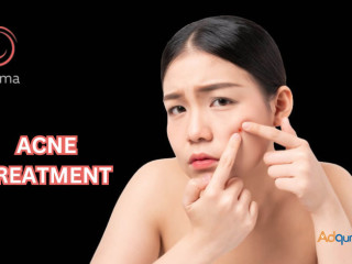 Acne treatment in Bangalore | Charma Clinic