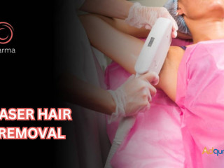 Laser Hair Removal in Bangalore - Charma Clinic