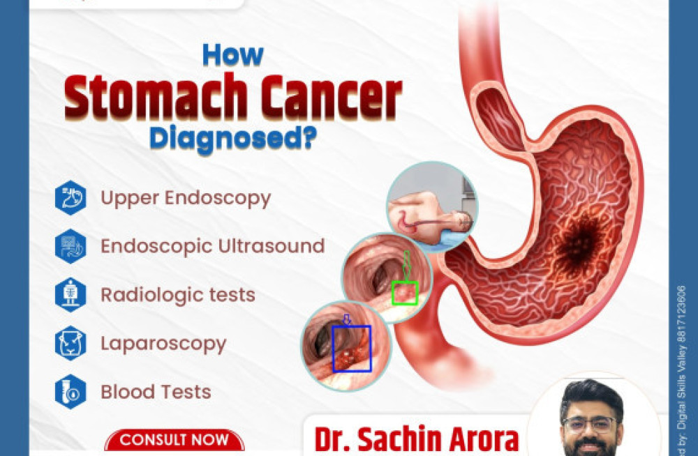 best-stomach-cancer-surgeon-in-dehradun-dr-sachin-arora-big-1