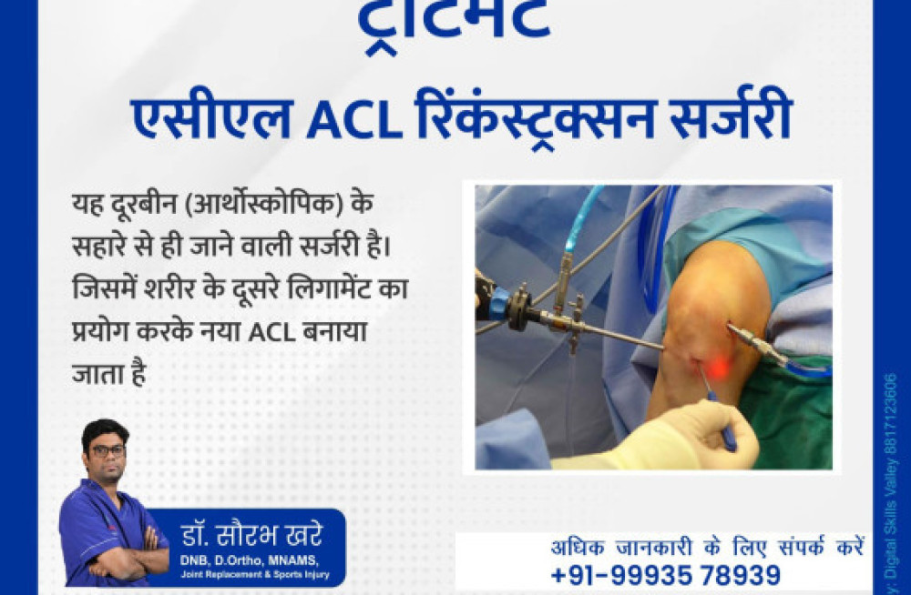 best-acl-reconstruction-surgery-in-raipur-dr-saurabh-khare-big-1