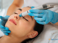 discover-radiant-skin-with-the-original-hydrafacial-at-ak-clinics-ludhiana-small-0