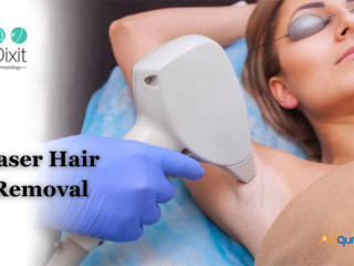 Laser Hair Removal Cost In Bangalore - Dr. Dixit Cosmetic Dermatology Clinic