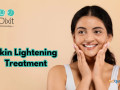 skin-lightening-treatment-in-bangalore-by-dr-rasya-dixit-small-0