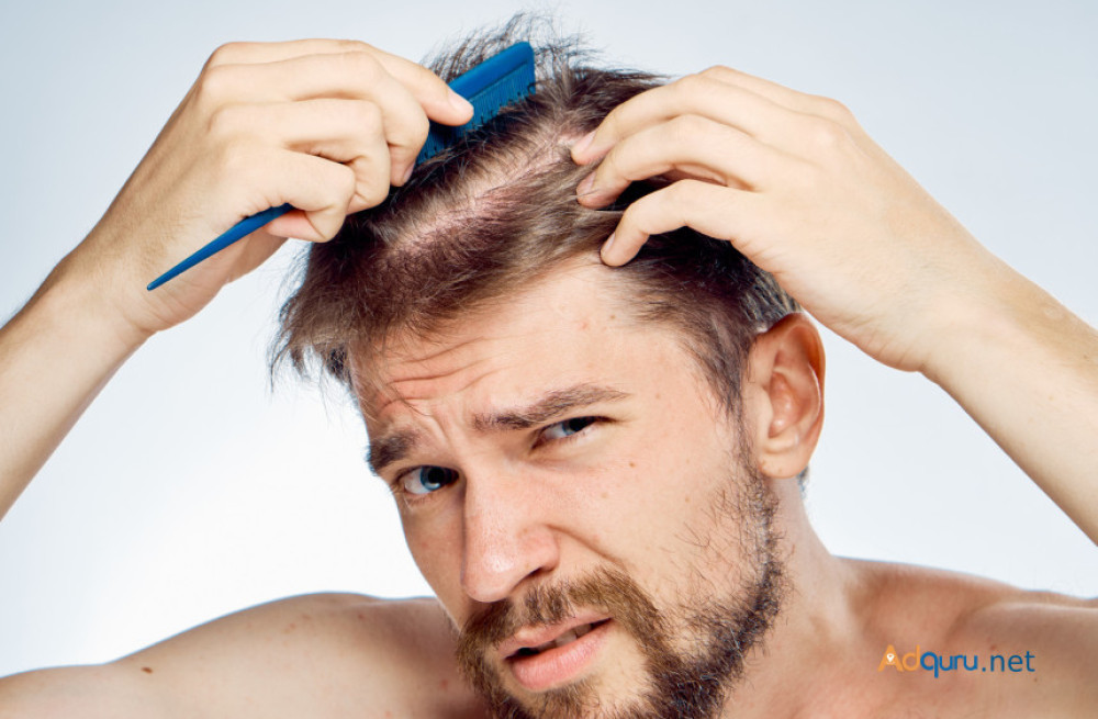 affordable-hair-transplant-cost-in-gurgaon-big-0