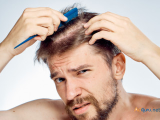 Affordable Hair Transplant Cost in Gurgaon