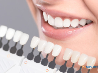 Find the Top Dentist in Gurgaon