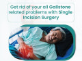 gallbladder-treatment-at-laparo-obeso-centre-pune-small-0