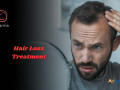 hair-loss-treatment-in-bangalore-jp-nagar-at-charma-clinic-small-0