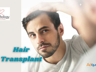 Best Hair Transplant In Gurgaon - SB Trichology