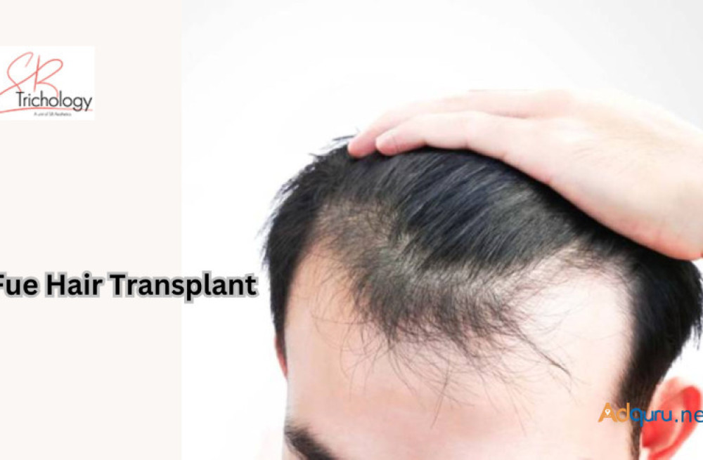 fue-hair-transplant-in-gurgaon-at-sb-trichology-big-0