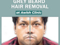 dr-vijay-kumar-best-dermatologist-specialist-in-delhi-ncr-awish-clinic-small-4