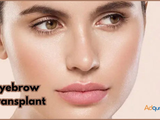 Eyebrows Transplant in Gurgaon at SB Trichology