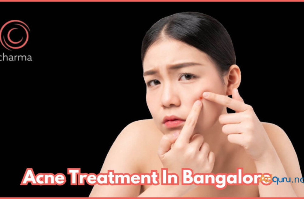 acne-treatment-in-bangalore-at-charma-clinic-big-0