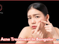 acne-treatment-in-bangalore-at-charma-clinic-small-0