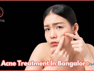 Acne Treatment in Bangalore - At Charma Clinic