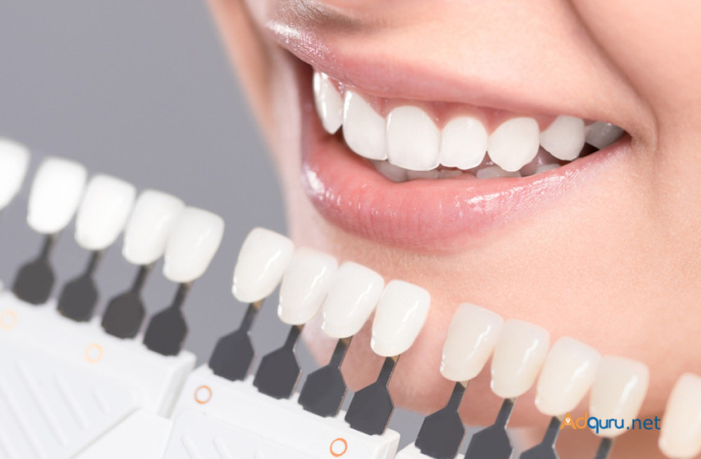 best-dental-implants-in-gurgaon-big-1