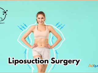 Best Liposuction Surgery in Bangalore