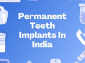 permanent-teeth-implants-in-india-small-0