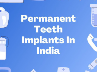 Permanent Teeth Implants In India