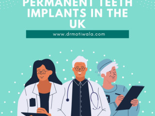 Permanent Teeth Implants In The Uk