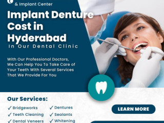 Implant Denture Cost in Hyderabad