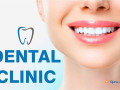 premium-dental-clinic-in-india-aesthetic-smiles-india-small-2