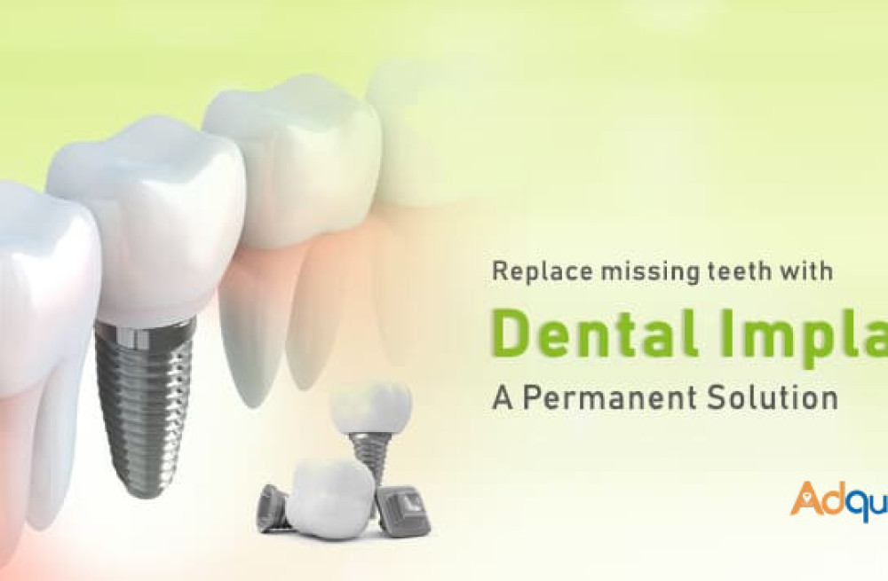 cost-effective-dental-implants-in-india-big-1