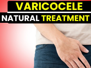 Varicocele natural treatment in india