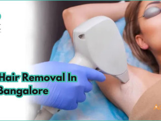 Best Laser Hair Removal in Bangalore