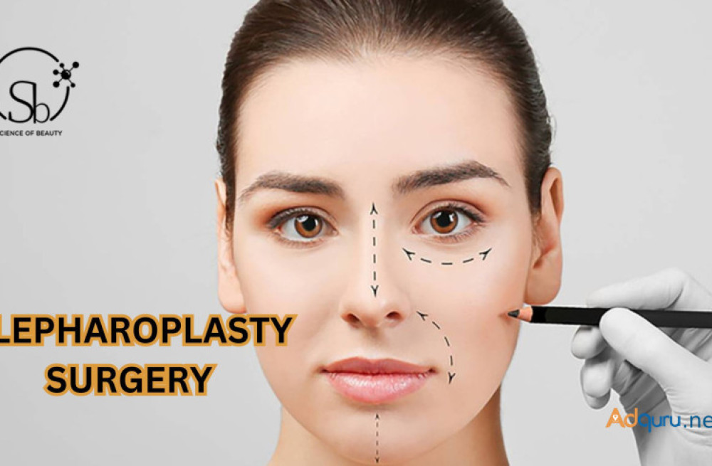 best-blepharoplasty-surgery-in-bangalore-big-0