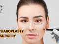 best-blepharoplasty-surgery-in-bangalore-small-0