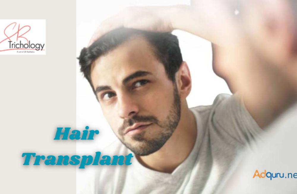 hair-transplant-in-gurgaon-sb-trichology-big-0