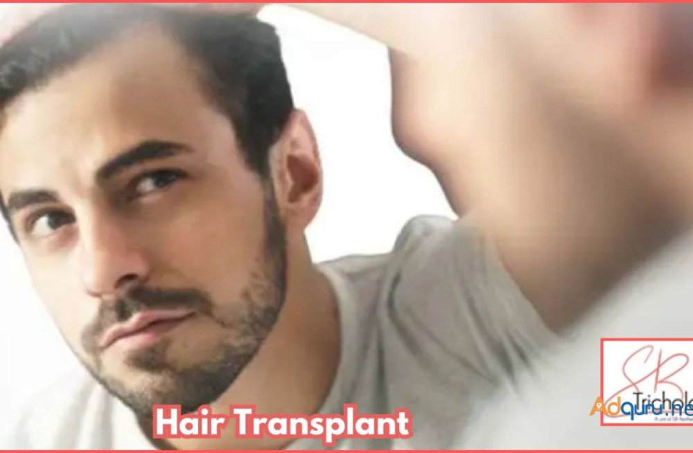 hair-transplant-cost-in-gurgaon-sb-trichology-clinic-big-0