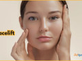 facelift-surgery-in-bangalore-small-0