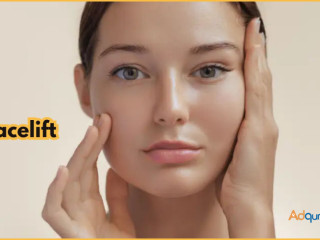 Facelift Surgery In Bangalore