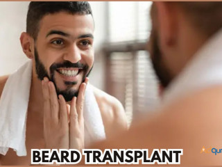 Best Beard Transplant in Gurgaon