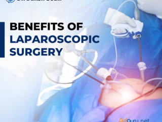 Best Laparoscopic Surgeon in Delhi