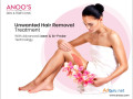 unwanted-hair-removal-treatment-with-advanced-technology-at-anoos-small-0