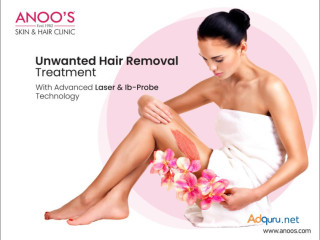 Unwanted Hair Removal Treatment with Advanced Technology at Anoos