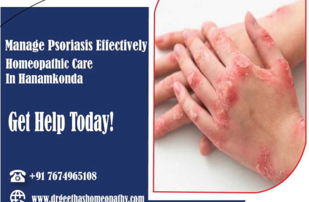 effective-homeopathy-treatment-for-psoriasis-in-hanamkonda-consult-dr-geethas-homeopathy-big-0