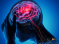 what-are-the-symptoms-of-a-neurological-problem-by-biovatic-small-0