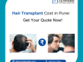 understanding-hair-transplant-costs-in-pune-thane-and-navi-mumbai-with-la-densitae-small-0