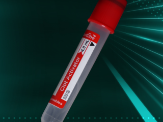 Optimize Your Laboratory with Reliable Serum Clot Activators by AV Consumable