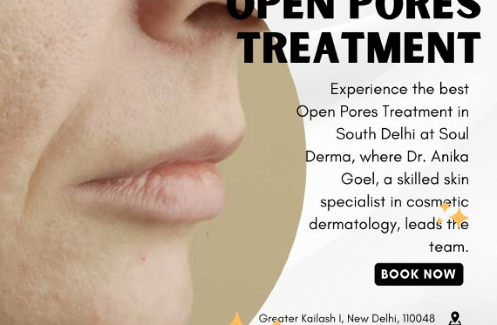 get-best-open-pores-treatment-in-south-delhi-at-soul-derma-big-0