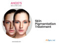 advanced-pigmentation-treatment-at-anoos-small-0